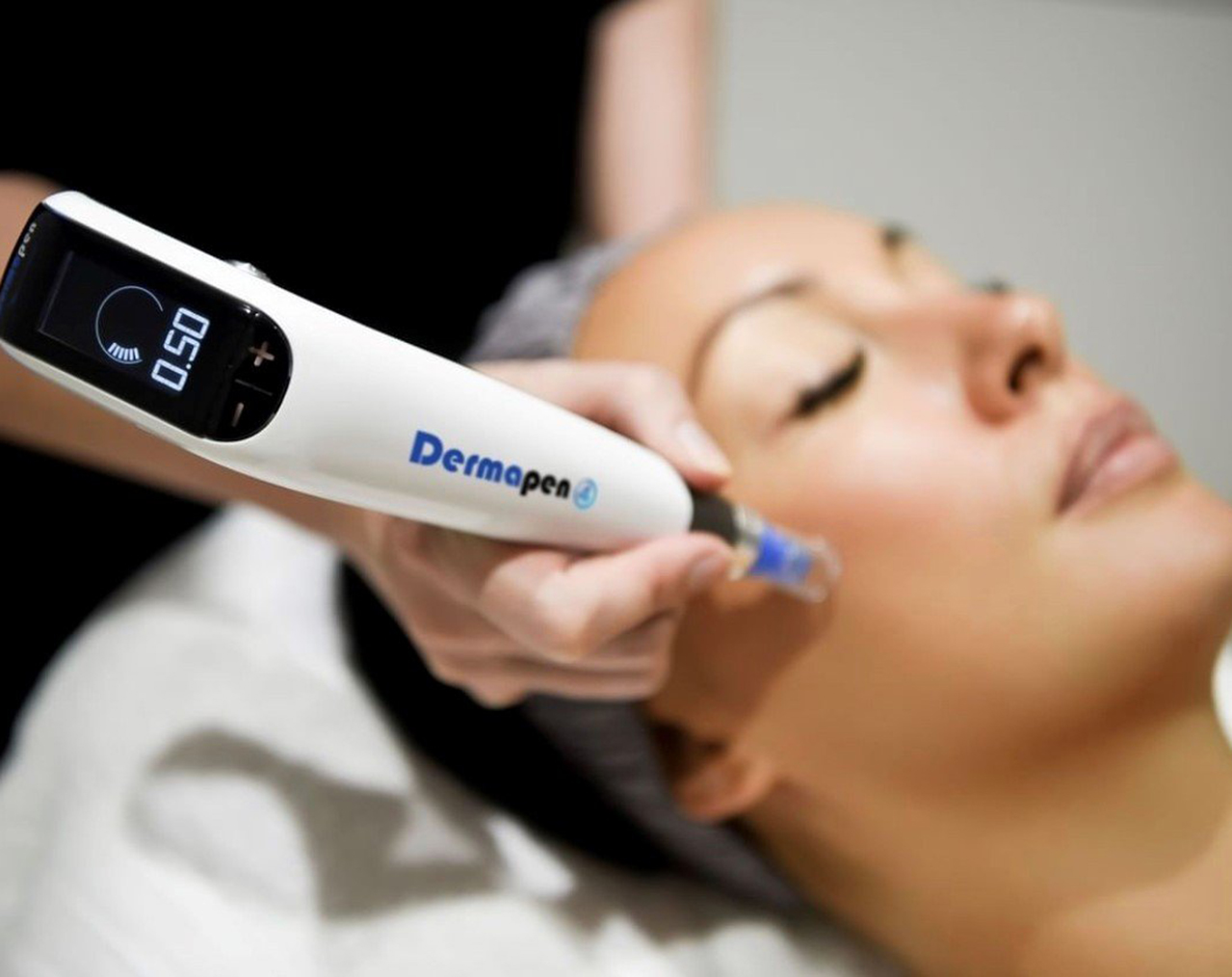 Dermapen Microneedling